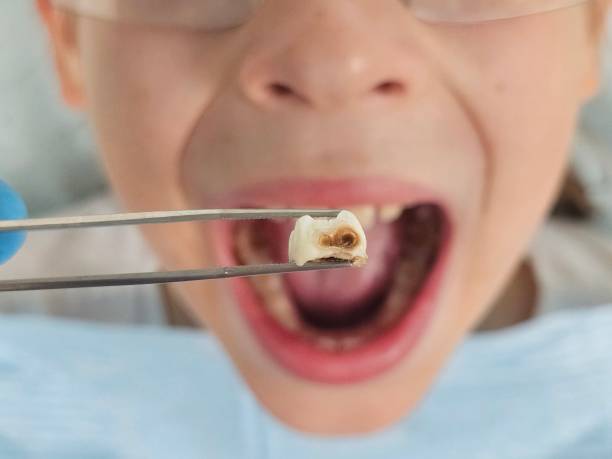 Best Emergency Cosmetic Dentistry (e.g., broken veneers) in Bellows Falls, VT